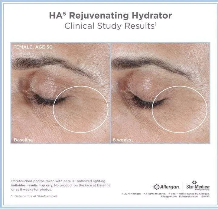 Spacewallart SkinMedica HA5 Rejuvenating Hydrator 2 oz hyaluronic acid moisturizer in sealed packaging, for youthful skin hydration