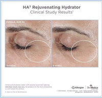 Spacewallart SkinMedica HA5 Rejuvenating Hydrator 2 oz hyaluronic acid moisturizer in sealed packaging, for youthful skin hydration